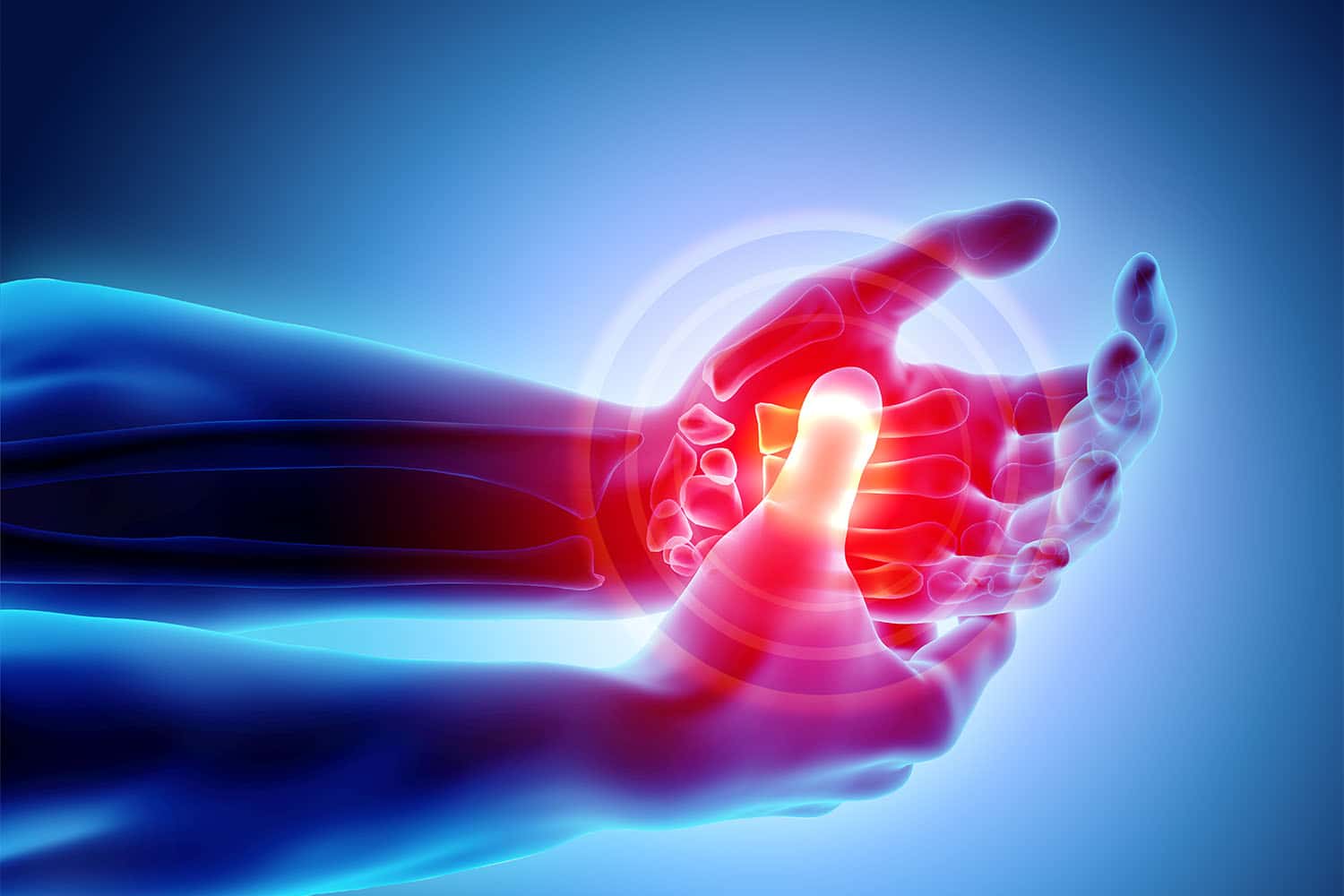 how-to-prevent-arthritis-in-hands